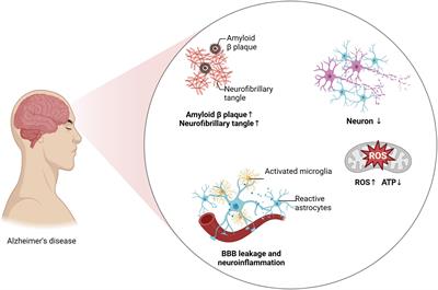 The impact of physical exercise on neuroinflammation mechanism in Alzheimer’s disease